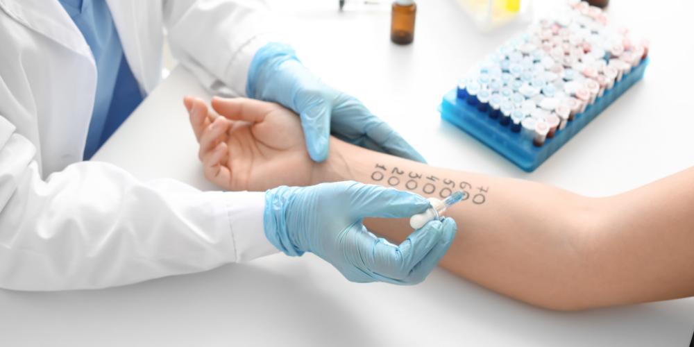 Medicare guidelines for allergy testing 